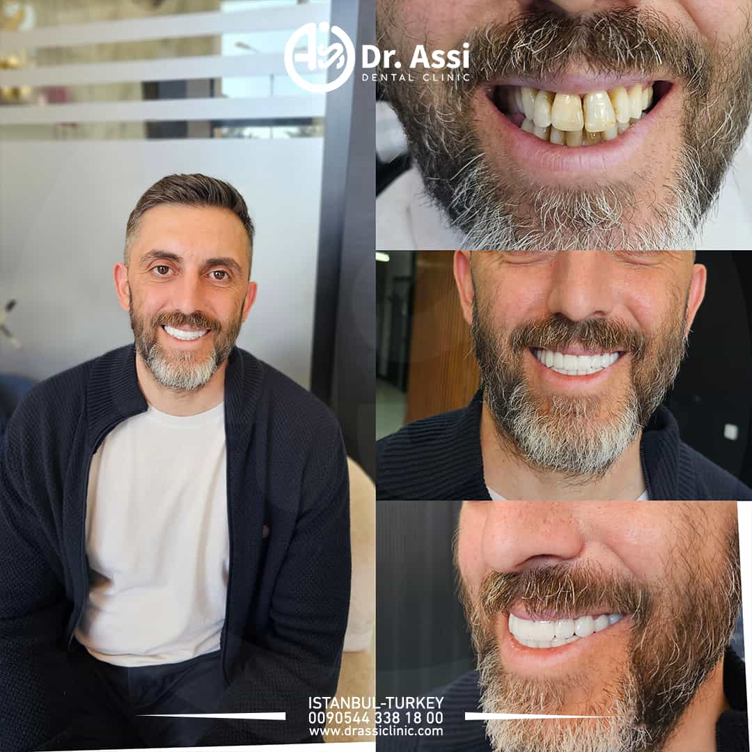 Clinique dentaire dr alaa assi